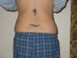 2 months after smart lipo - back